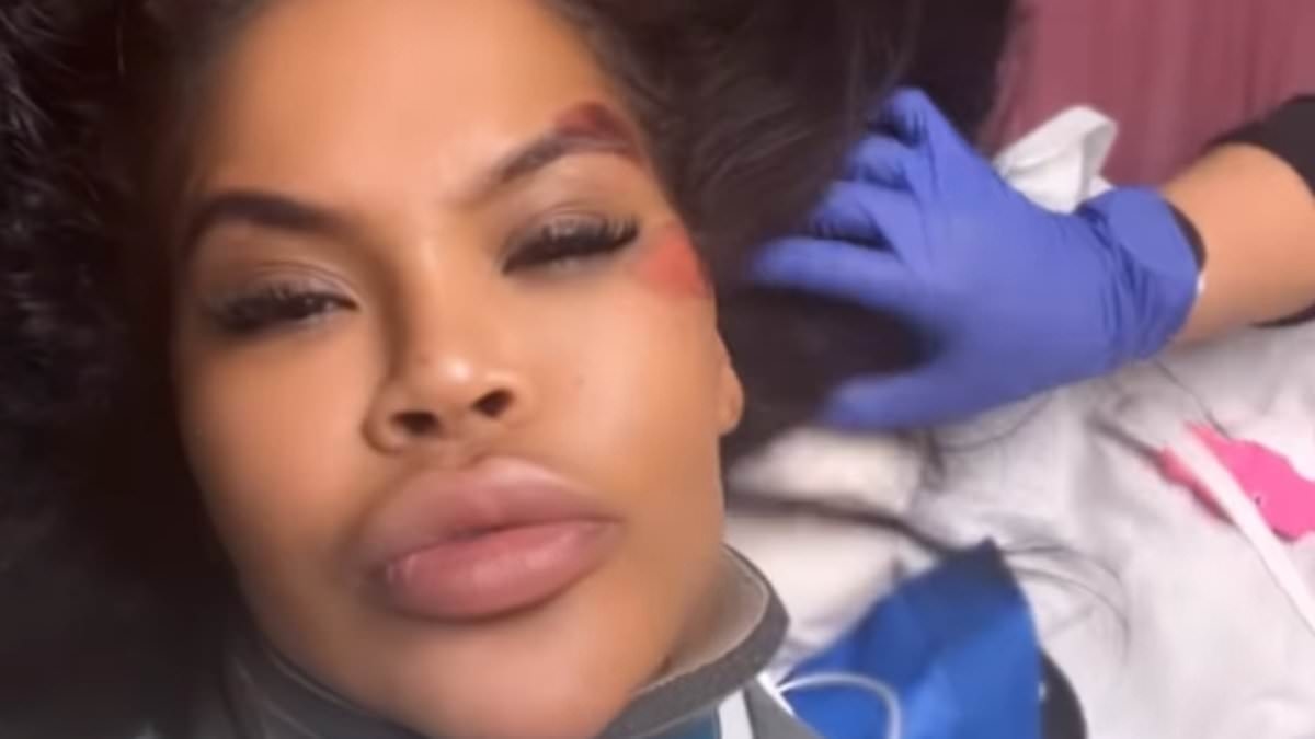 Big Brother star is rushed to hospital with painful injuries after being 'left for dead' in shock car crash