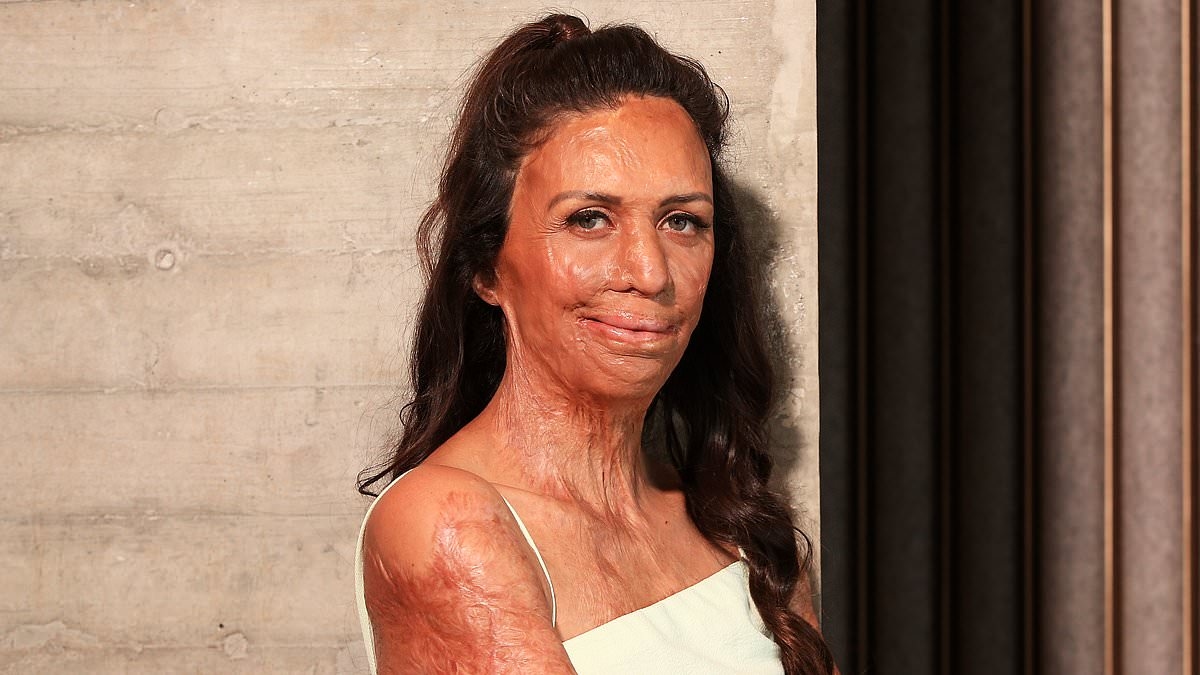 Inspirational burns survivor Turia Pitt reveals new career move after being forced to change her life as she was 'pushing her own needs aside'