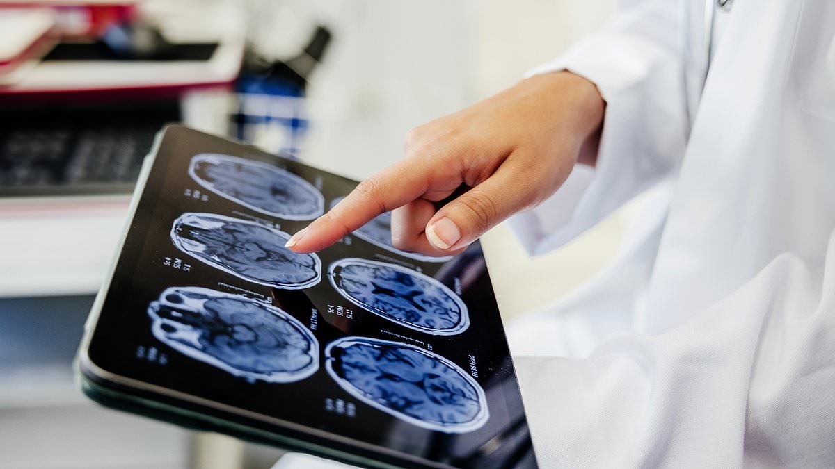 Top expert reveals shocking first sign of type of dementia that hits in your 30s - 'patients think it's normal'