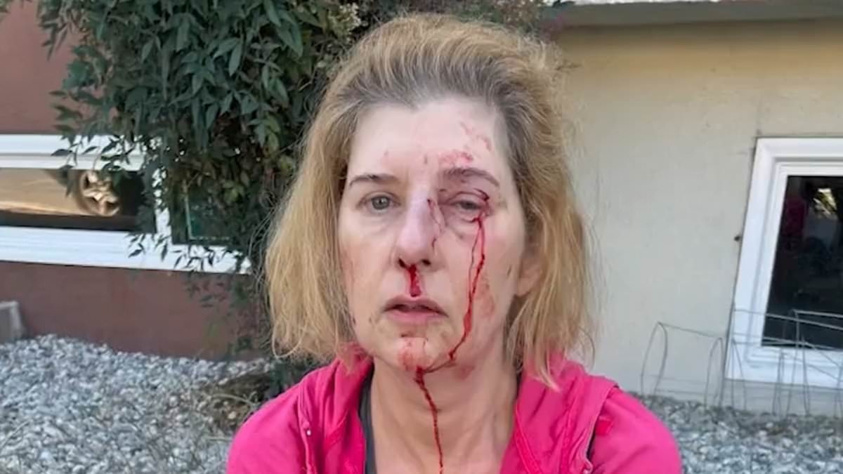 Distraught LA woman, 52, shares what violent homeless man did to her in unprovoked attack