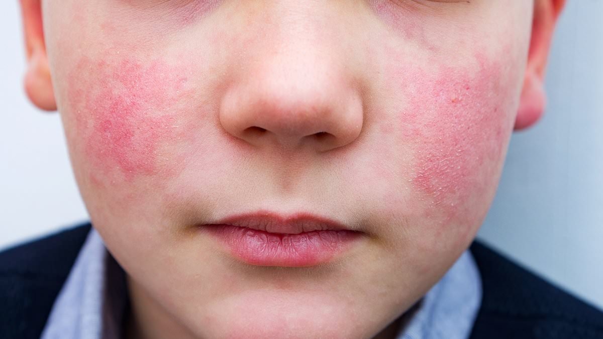 Dermatologists' horror as babies aged just six months are treated for skin conditions caused by wearing 'too much perfume and makeup'