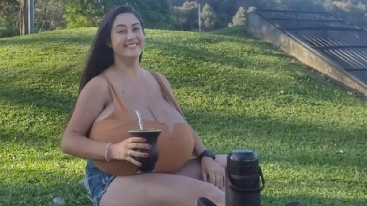Woman's breasts balloon to 26 POUNDS in just months... and what doctors found was shocking