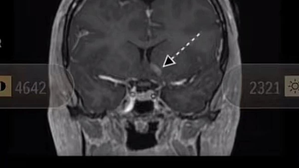 Husband's disgusting act after his wife was diagnosed with brain cancer: 'What the hell was going on'