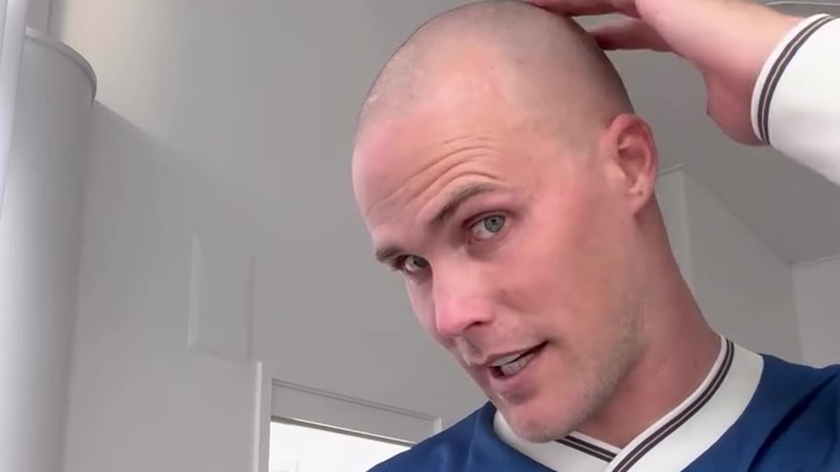 Jett Kenny, 31, reveals he is going bald and is considering getting a Turkish hair transplant