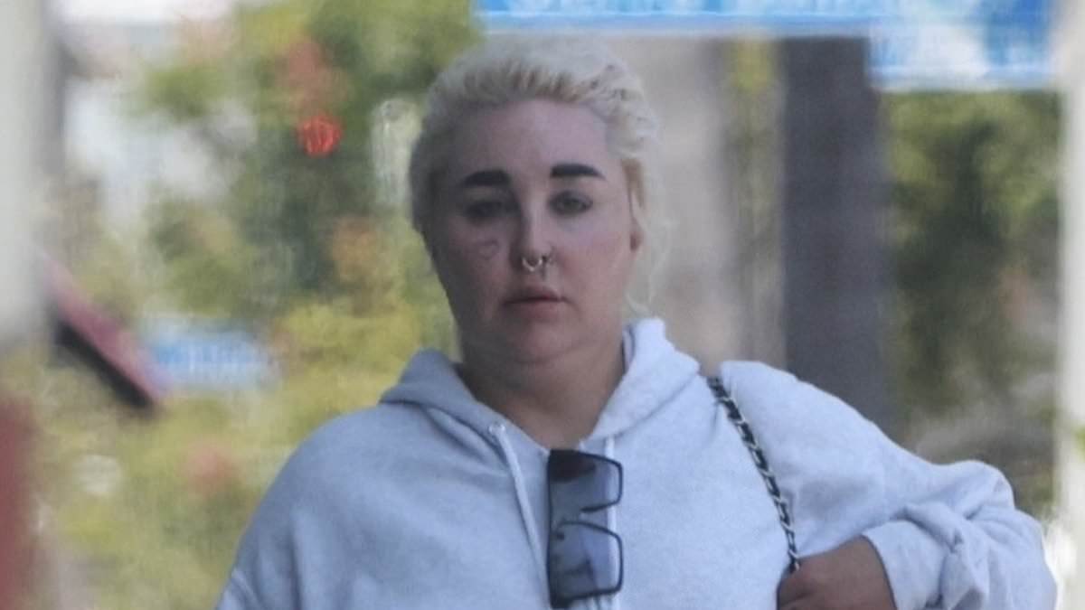 Amanda Bynes vapes on solo outing in West Hollywood after revealing drastic new weight-loss attempt