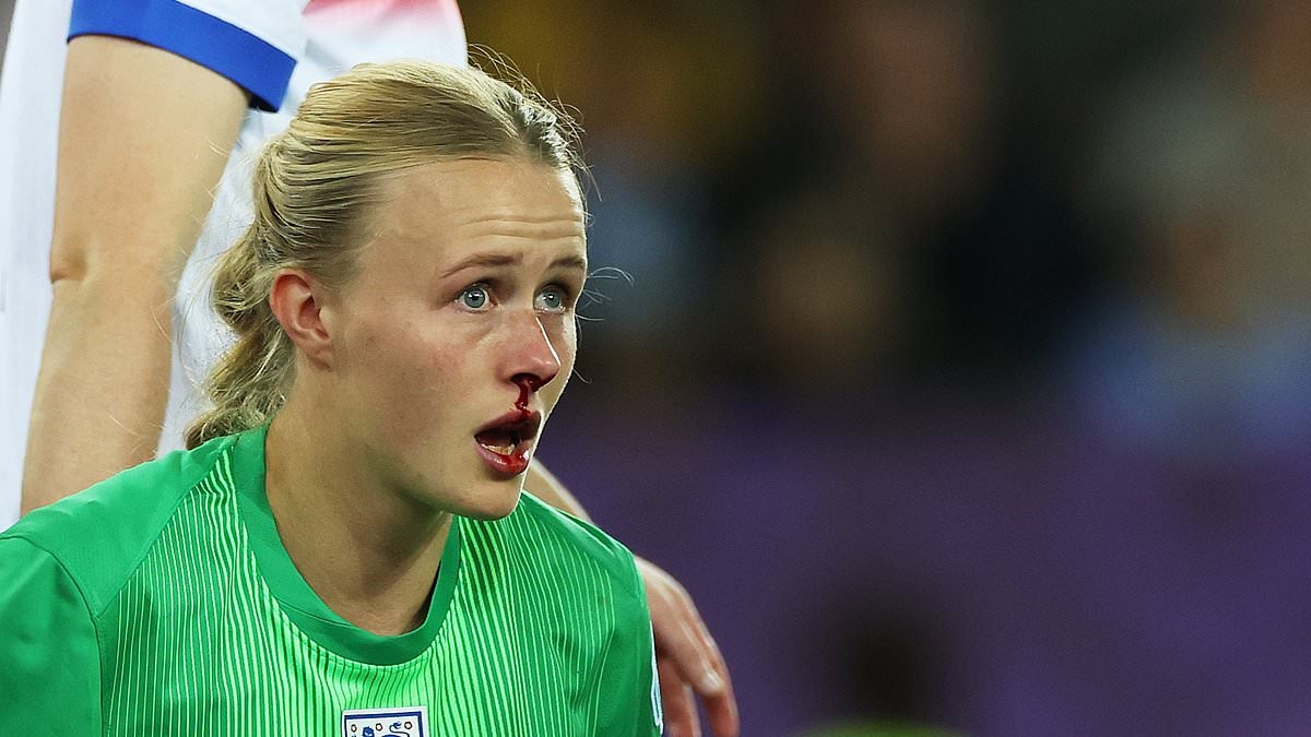 Lionesses' bloody-nosed hero: Hannah Hampton's health issues mean she struggles to pour herself a glass of water - but she forced Mary Earps into retirement