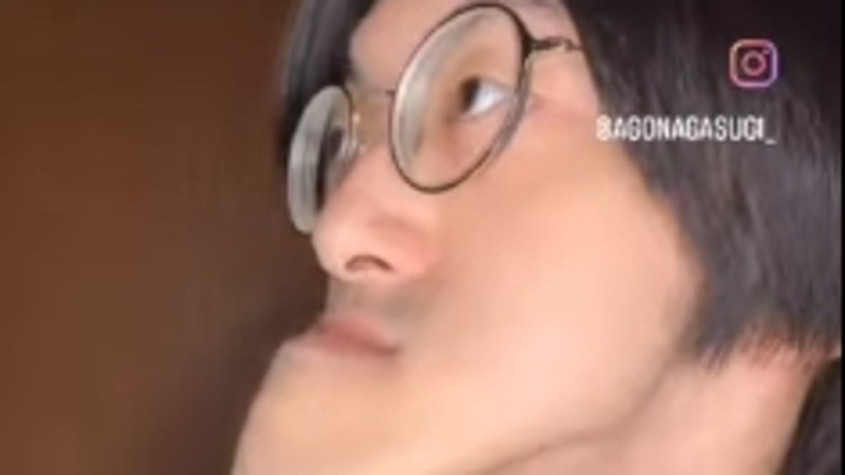 I have the world's longest chin... doctors have no idea why it didn't stop growing, but I blame something I ate