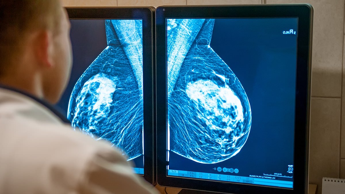 New test taken two weeks after starting treatment for breast cancer can tell if the disease is likely to return