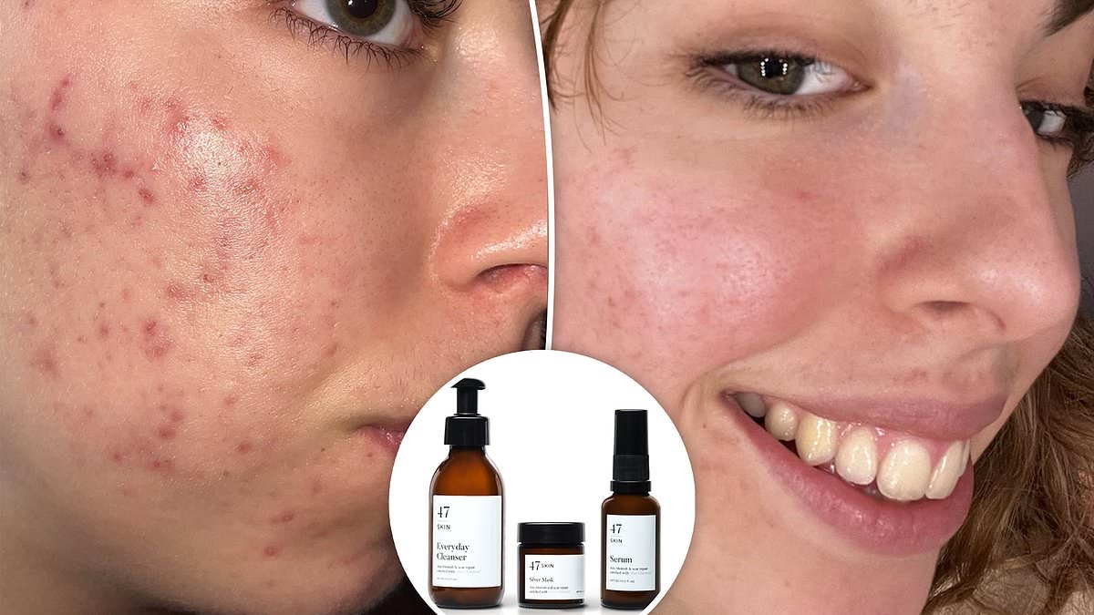 This little-known skincare brand clears skin fast - and it's on sale: 'I FINALLY feel confident going makeup-free at the beach!'