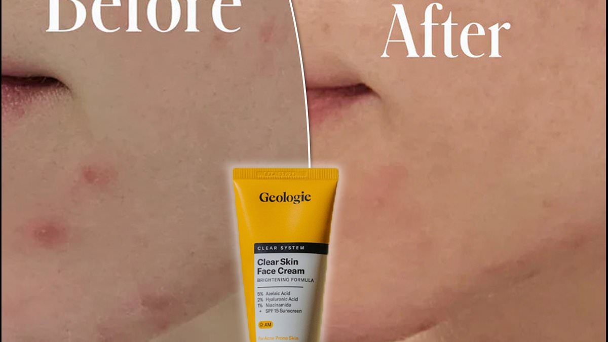 Derm-designed, budget-approved: The under $50 acne routine shoppers say 'works like MAGIC' for clear skin