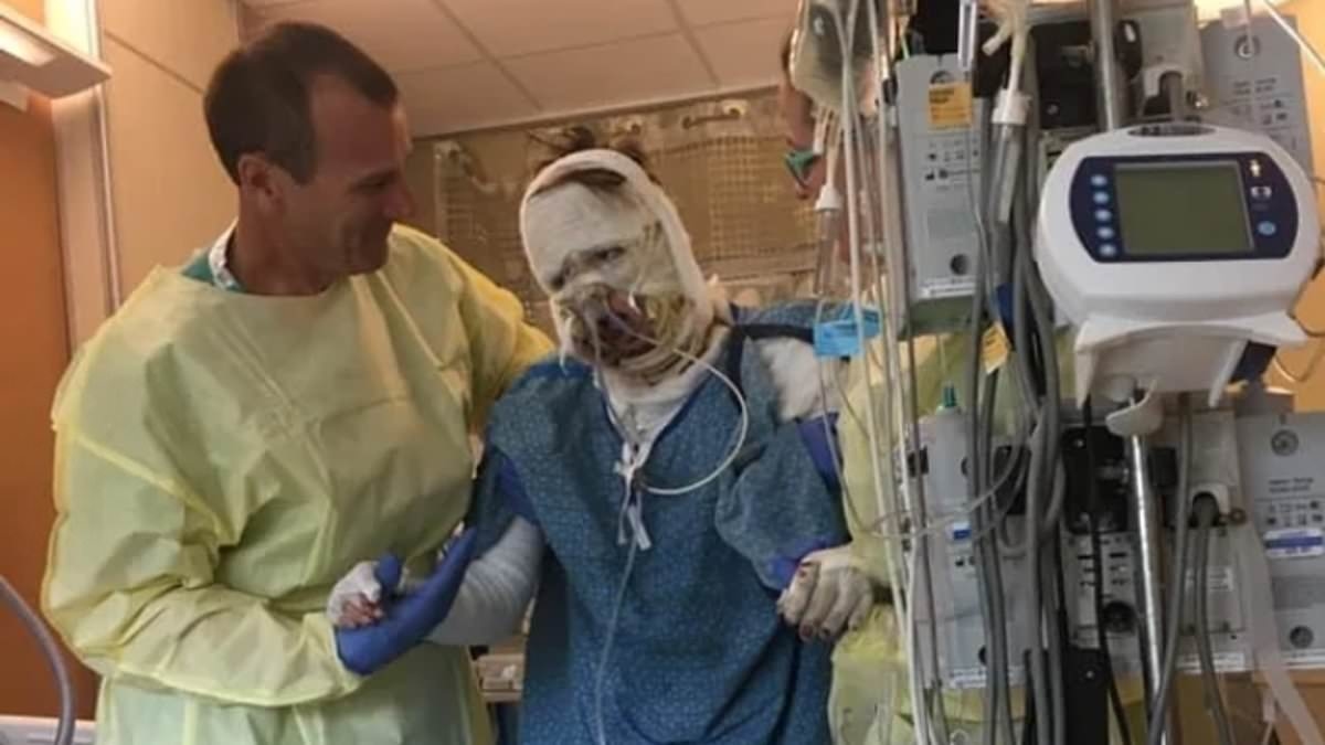 Woman who burned 40 per cent of her body in petrol station fireball reveals what she looks like six years later