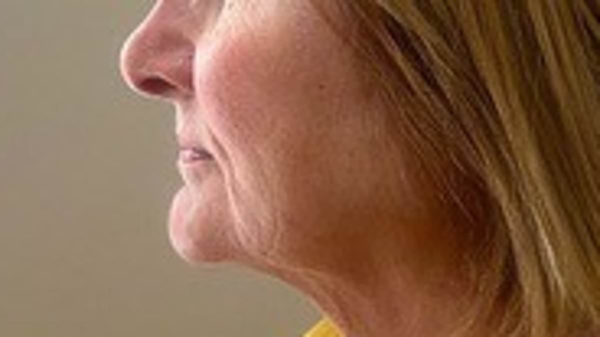 Revealed: The women who look 10 years younger WITHOUT Botox and credit non-invasive procedures for their incredible transformations