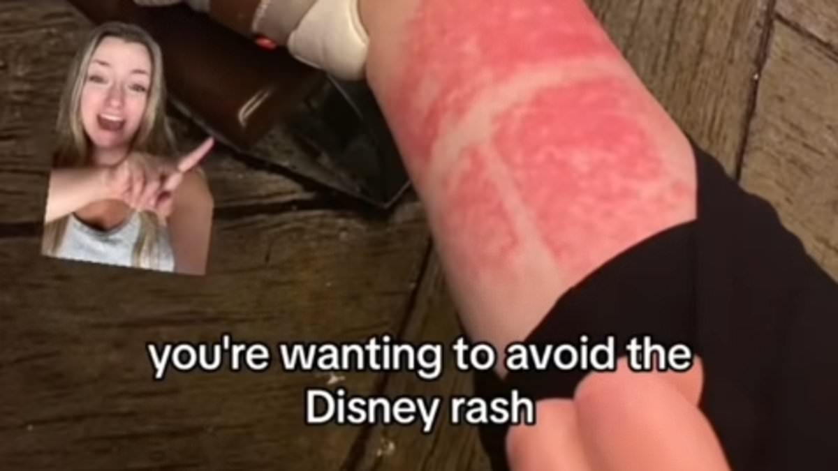 Travel expert issues warning over 'incredibly painful' Disney rash