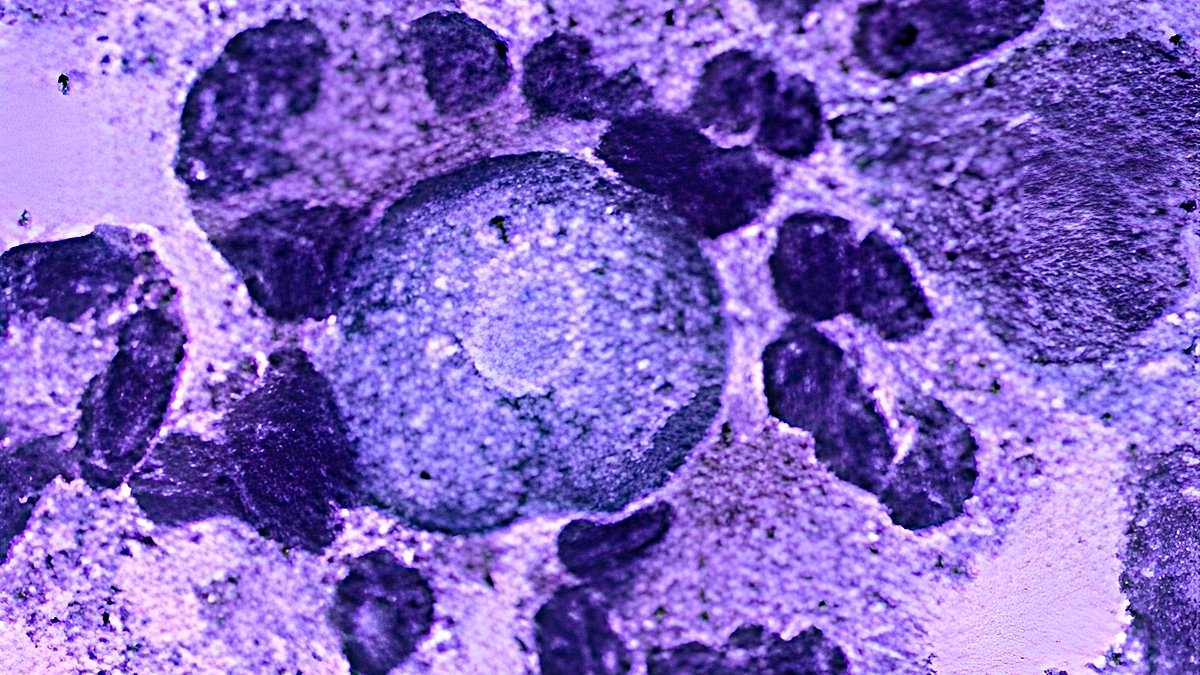 Child dies from brain-eating amoeba after doing favorite summertime activity