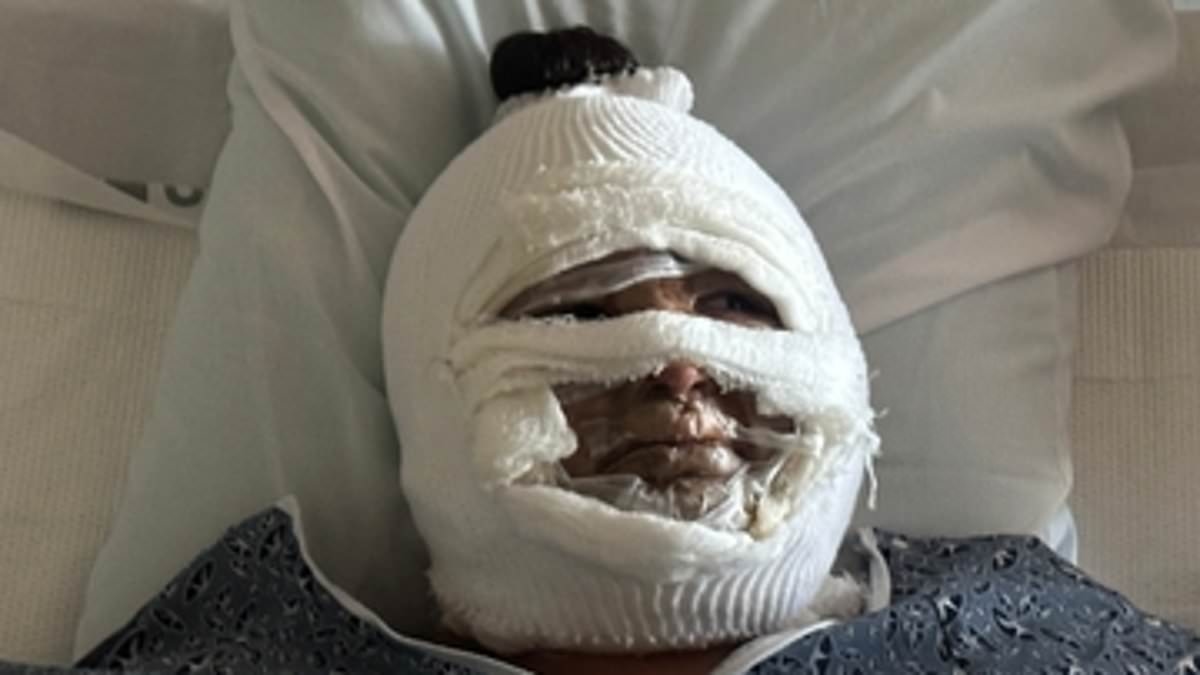 California woman, 18, is disfigured in freak accident involving s'mores on a tabletop firepit