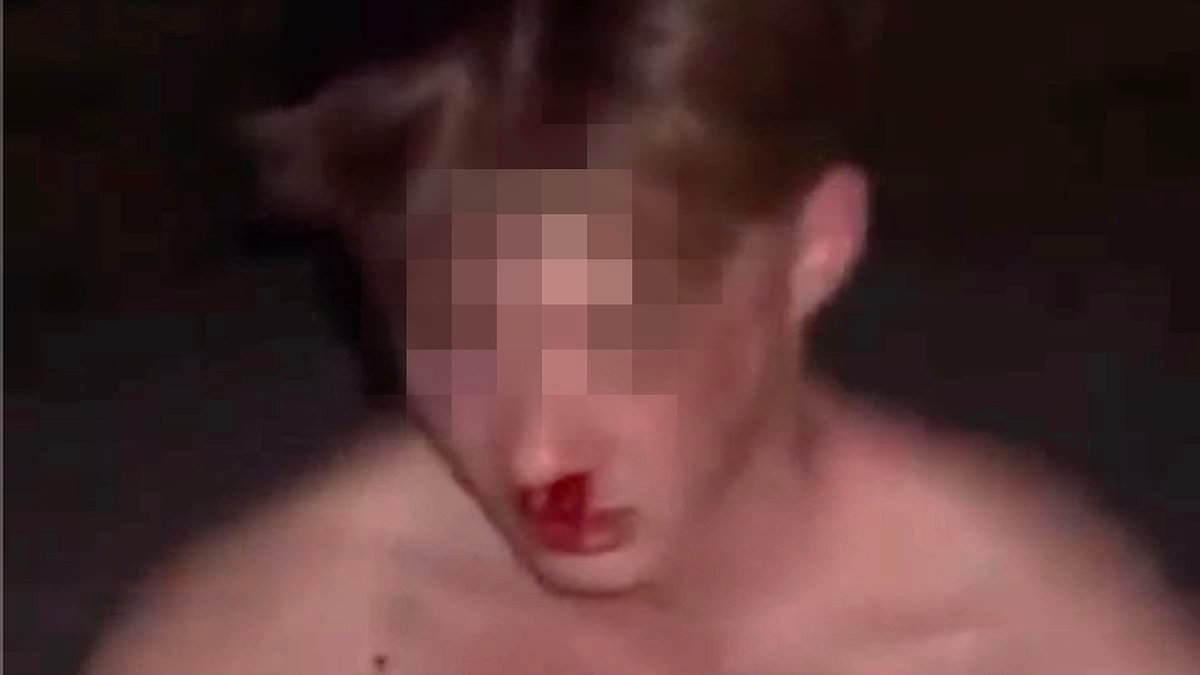 British teen kicked in the head during disturbing street robbery in Portugal