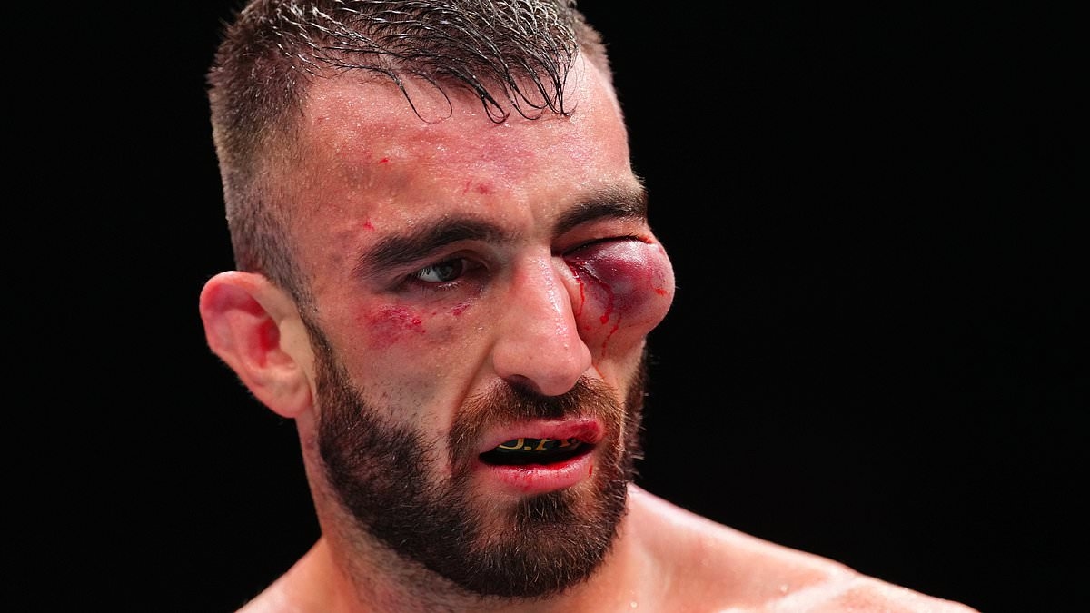 UFC fighter left completely disfigured by gruesome injuries as fans call for referee to be fired over brutal bout