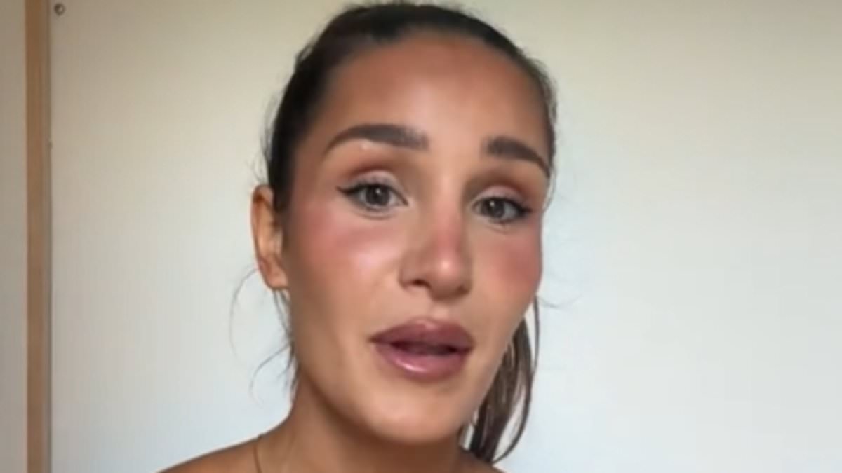 Fitness influencer Kayla Itsines breaks down in tears as she reveals mental health struggle: 'I can't be silent'