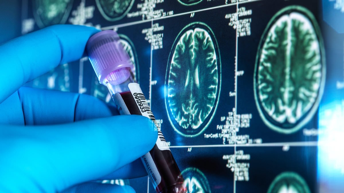 Is THIS the diet that can prevent dementia? New study pinpoints the sorts of food your body needs to stave off memory-robbing disease