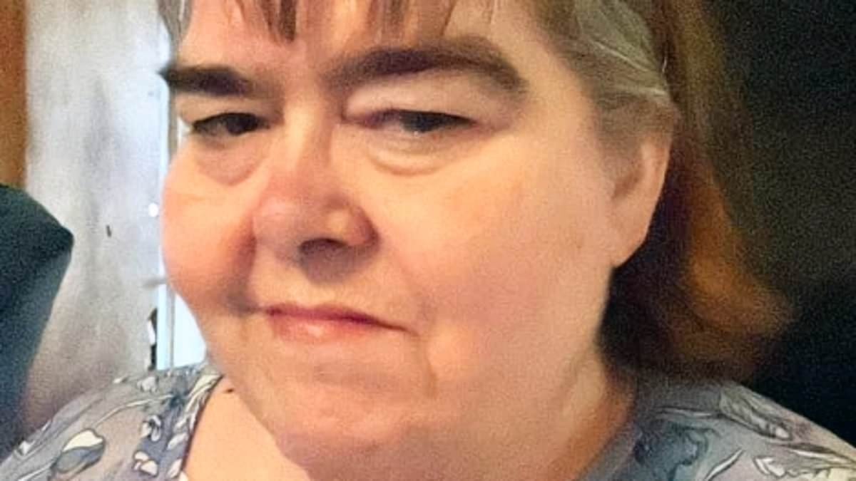 Mother from hell neglected son so badly his legs rotted off, police say