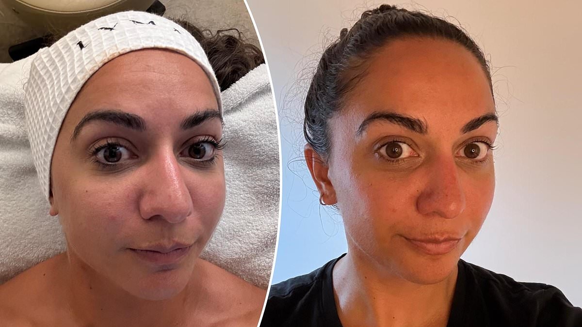 I tried the 'world's most in–demand facial': £450 'non–surgical facelift' combines lasers, massage and oxygen mist – and promises to make you look younger in just 90 minutes