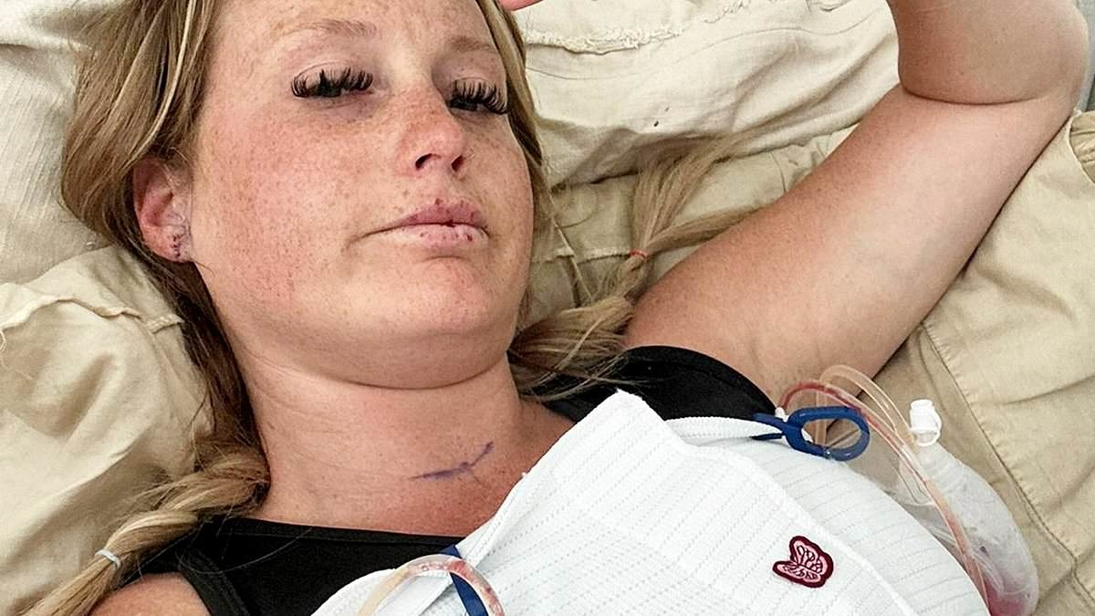 Mother issues urgent warning after she was left paralysed following routine Botox top-up