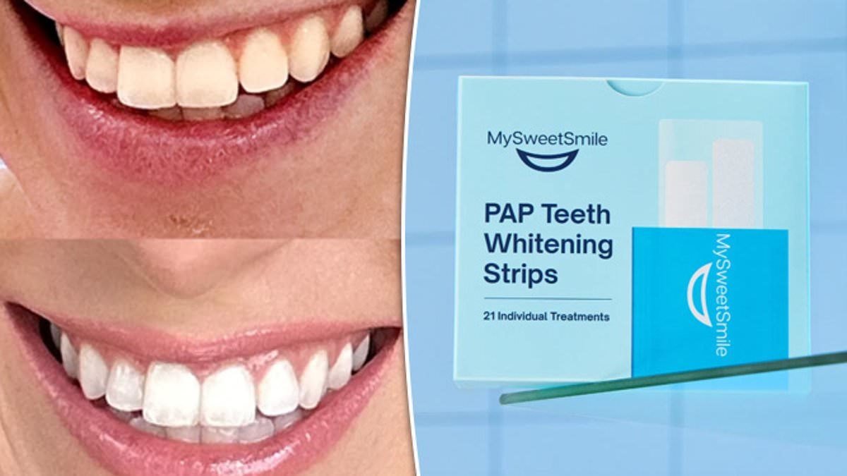 Shoppers are racing to buy the teeth whitening strips everyone's talking about for under £21: 'My teeth are visibly whiter'