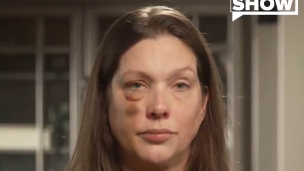 Woman beaten to a pulp in Cincinnati brawl says city's police chief and mayor have ignored her
