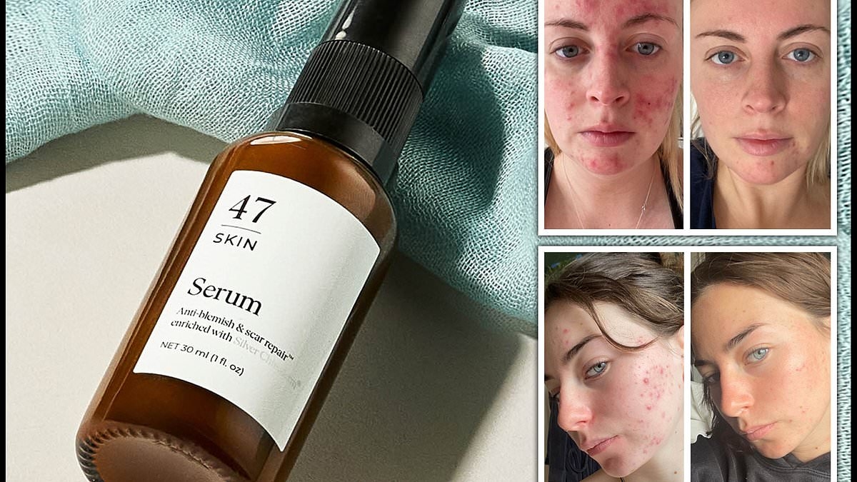 The priming skin serum that banishes breakouts to leave skin glowing - and it uses a VERY unique ingredient: 'My skin has never looked so clear'