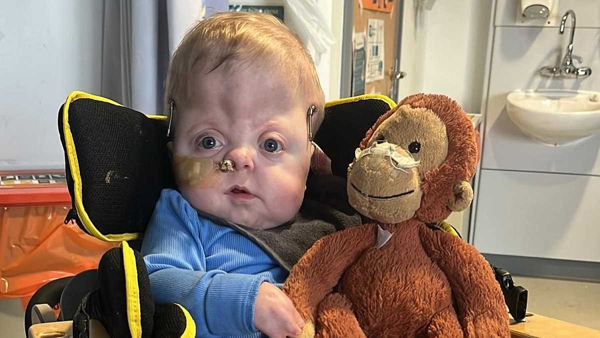 Geordie Shore star Aaron Chalmers's ex Talia Oatway reveals their son Oakley, three, may need a wheelchair and admits she is often in tears over his Apert Syndrome