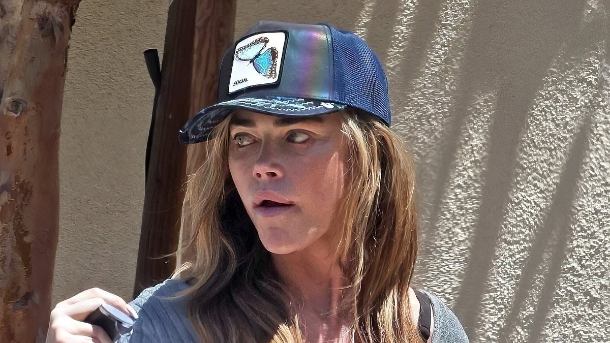Denise Richards steps out with 'black eye' days after cop confrontation at ex Aaron Phypers' home