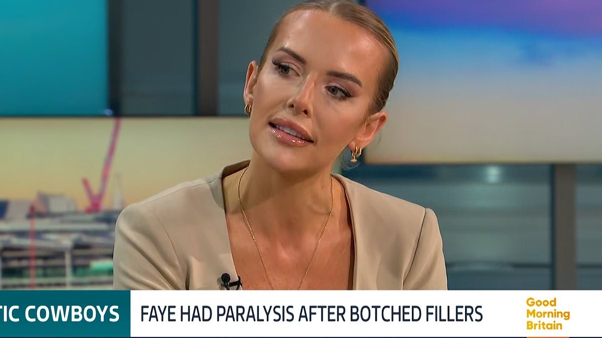 Love Island star Faye Winter opens up about 'botched' beauty treatment: 'I didn't know if I'd ever regain feeling in my forehead'