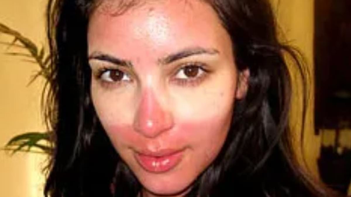 Kim Kardashian's sunburn and Vanessa Hudgens's bikini slip top the list of iconic getaway disasters