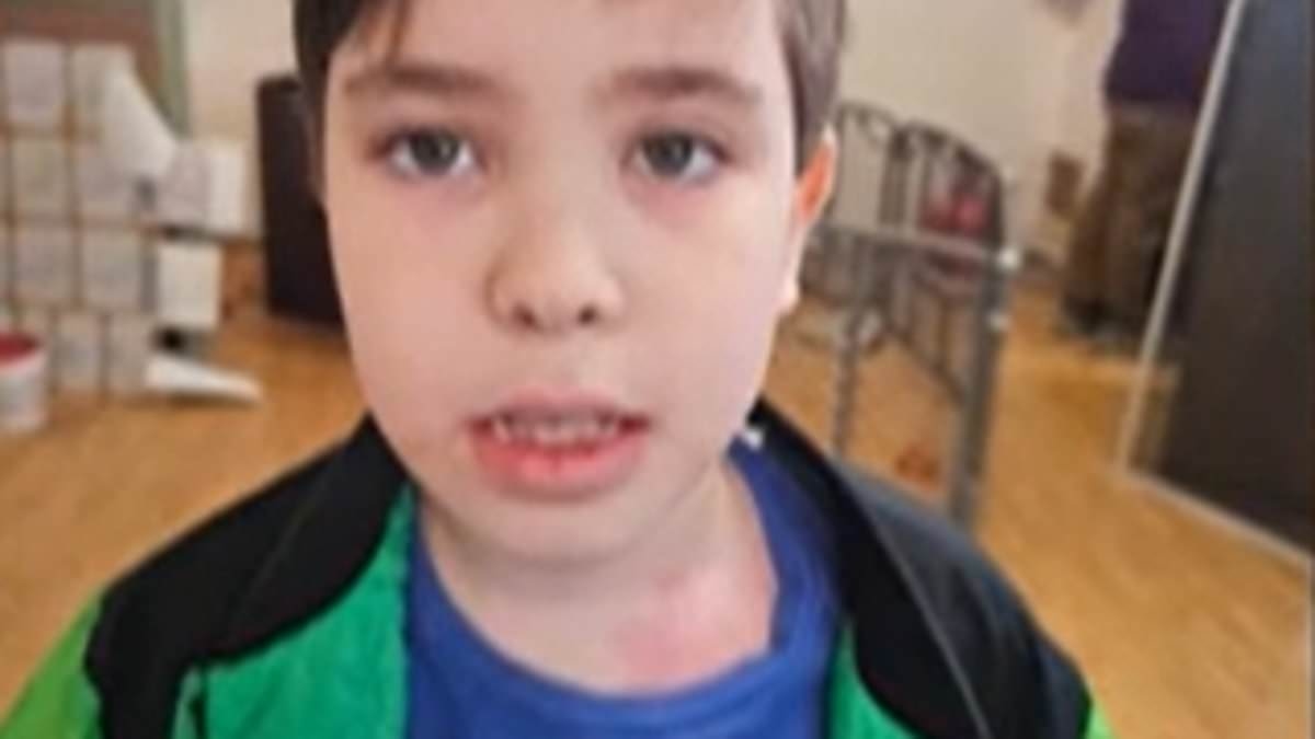 Vile dog owner speeds off Dukes of Hazzard-style after letting vicious pet rip autistic boy's ear open