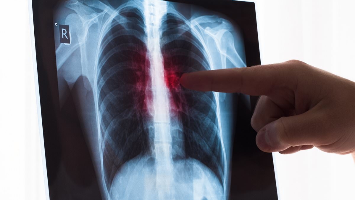 Plastic surgeon warns of killer complication linked to weight loss jabs