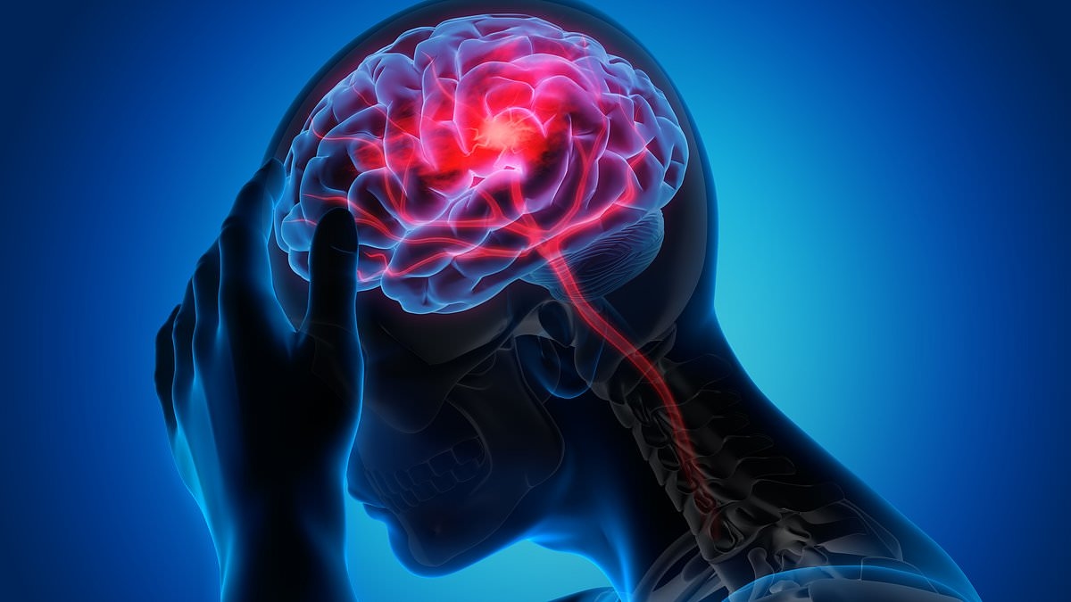 Chances of a stroke before age 50 may be higher in women who have had high-risk complications in pregnancy