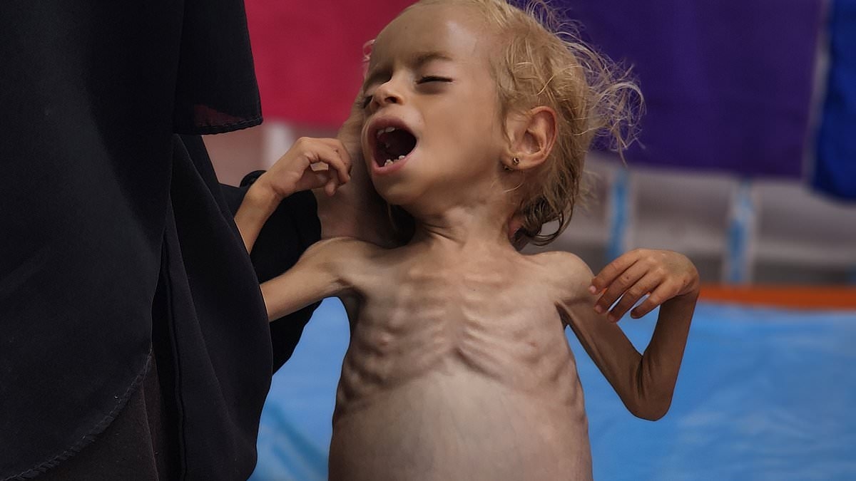 Harrowing images show skeletal Palestinian boy, two, crying out as 11 more die from malnutrition in Gaza, Hamas-run health ministry claims