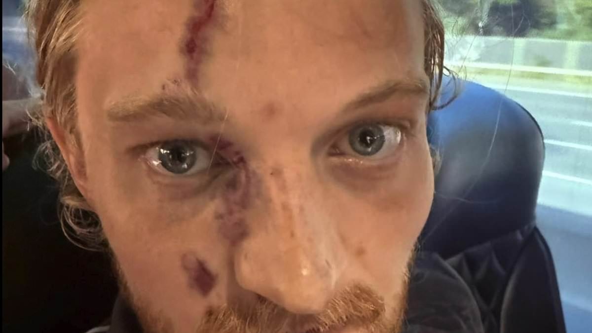 Footballer left with horror facial injury after being kicked in the HEAD by opponent during match