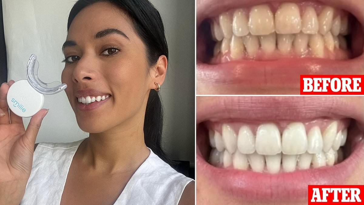 The dentist-approved item shoppers swear by for whiter and brighter teeth in just six days: 'I get so many compliments'