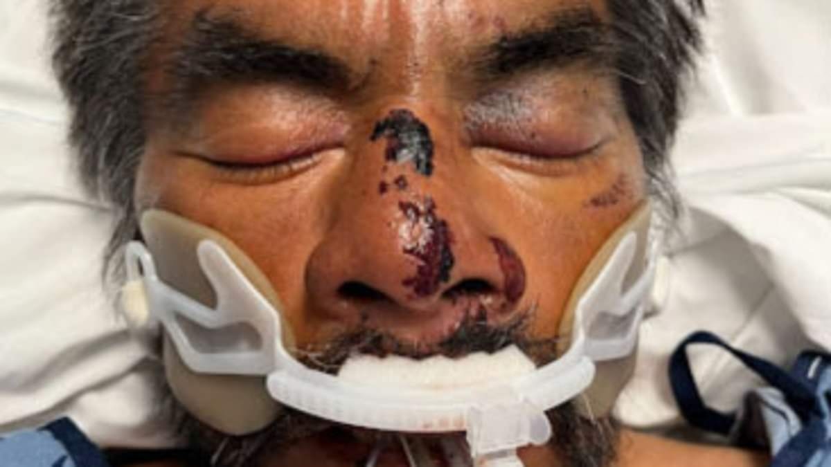 'America's saddest man' beaten up and taken to LA hospital...but no one knows who he is