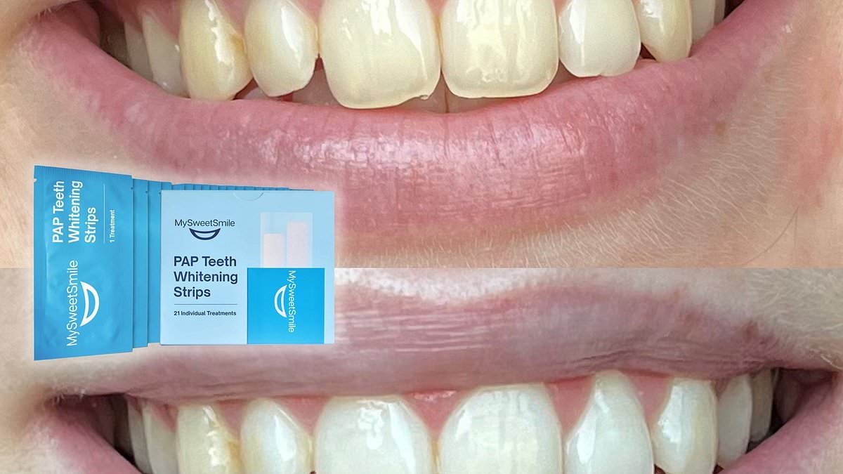 I tried the £25 peroxide-free whitening strips that leave teeth 'gleaming' without sensitivity - here's what I thought