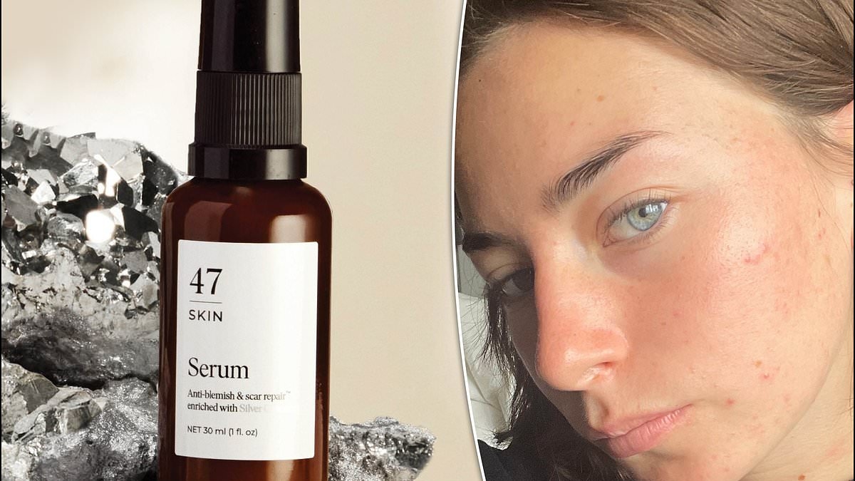 Begone, acne: The unique ingredient that kills bacteria, zaps zits, and clears skin: 'I went out without makeup for the first time in a decade!'