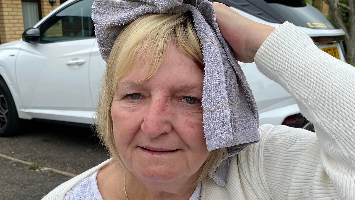 Woman, 70, is hospitalised after seagull attacks her as she walks down the street