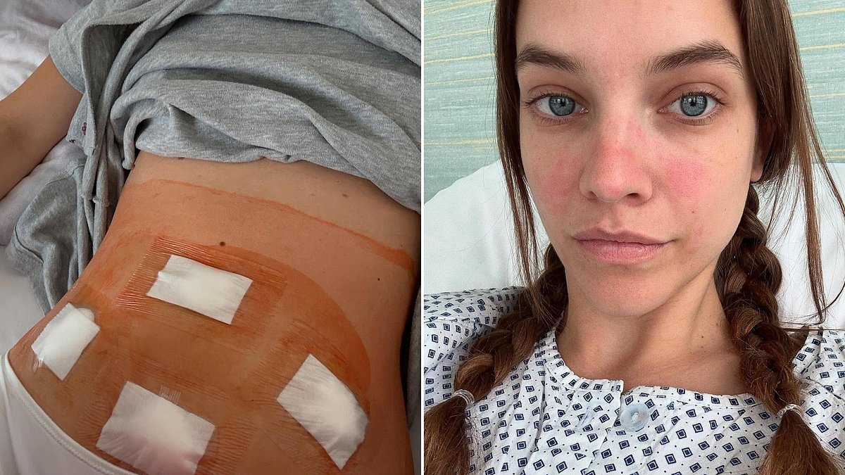 Dylan Sprouse's wife Barbara Palvin, 30, gets secret surgery after suffering 'sleepless nights on the floor'