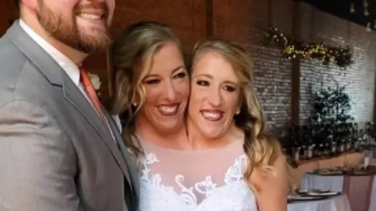 Conjoined twins Ultra rare conjoined twins are spotted with a newborn in tow nine months after sparking pregnancy rumours - but how can they have a baby?