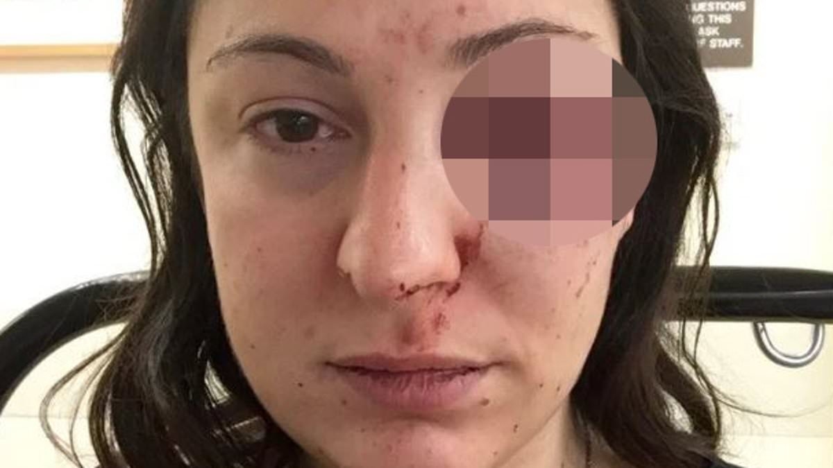 Tesco shopper who was beaten in the street after she stood up to shoplifters reveals how her ordeal has ruined her life
