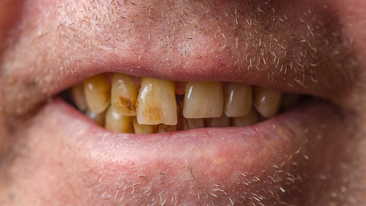 What the colour of your TEETH says about you, according to science