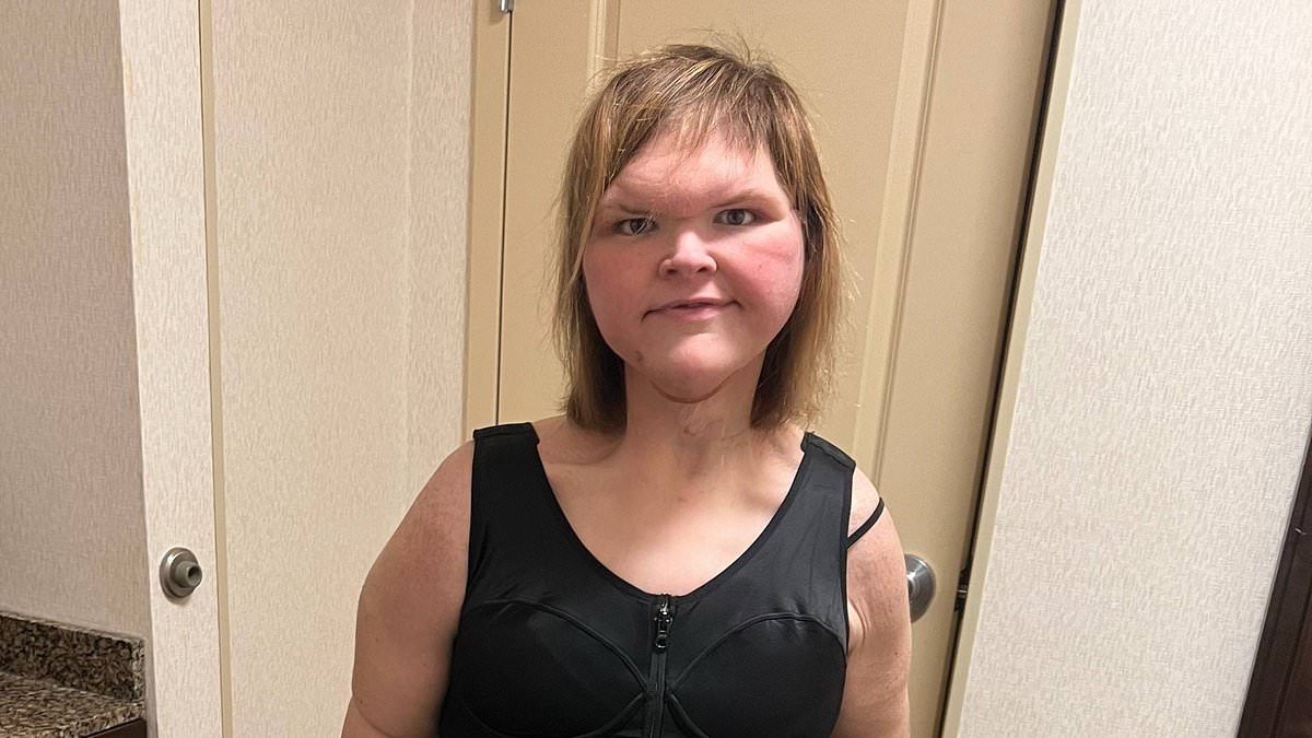 1000-lb Sisters star Tammy Slaton shows off new teeth after dramatic weight loss
