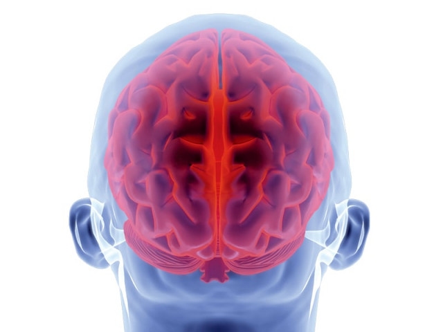 Pakistan faces surge in brain disorders
