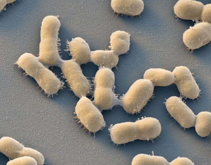 Antimicrobial Resistance termed a 'health crisis'